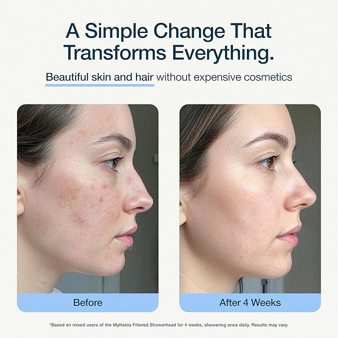 MyHalos® Filtered Shower Head for Hard Water Filter - High Pressure, Removes Chlorine - Shower Head Filter for Hard Water Softener Showerhead, Easy Install, For Hair & Skin, Filtering (Brushed Metal)