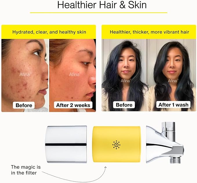 Afina Shower Filter For Hard Water - Removes 99% Chlorine, Harmful Substances & Heavy Metals - Improves your Skin & Hair (Chrome)