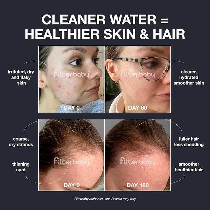 Filterbaby Pro Series Shower Filter,Doctor Developed,All-Metal Titanium Aluminum,Lab Tested to Reduce up to 99% Chlorine/Chloramine/Lead/Certain Heavy Metals, Great Water Pressure,Long Lasting,Gold